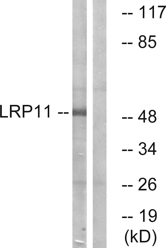 Polyclonal Rabbit anti-Human LRP11 Antibody (aa48-97, IHC, WB)
