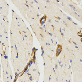 Polyclonal Rabbit anti-Human LAMP3 / CD208 Antibody (IHC, WB)