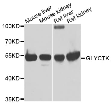 Polyclonal Rabbit anti-Human GLYCTK / Glycerate Kinase Antibody (WB)