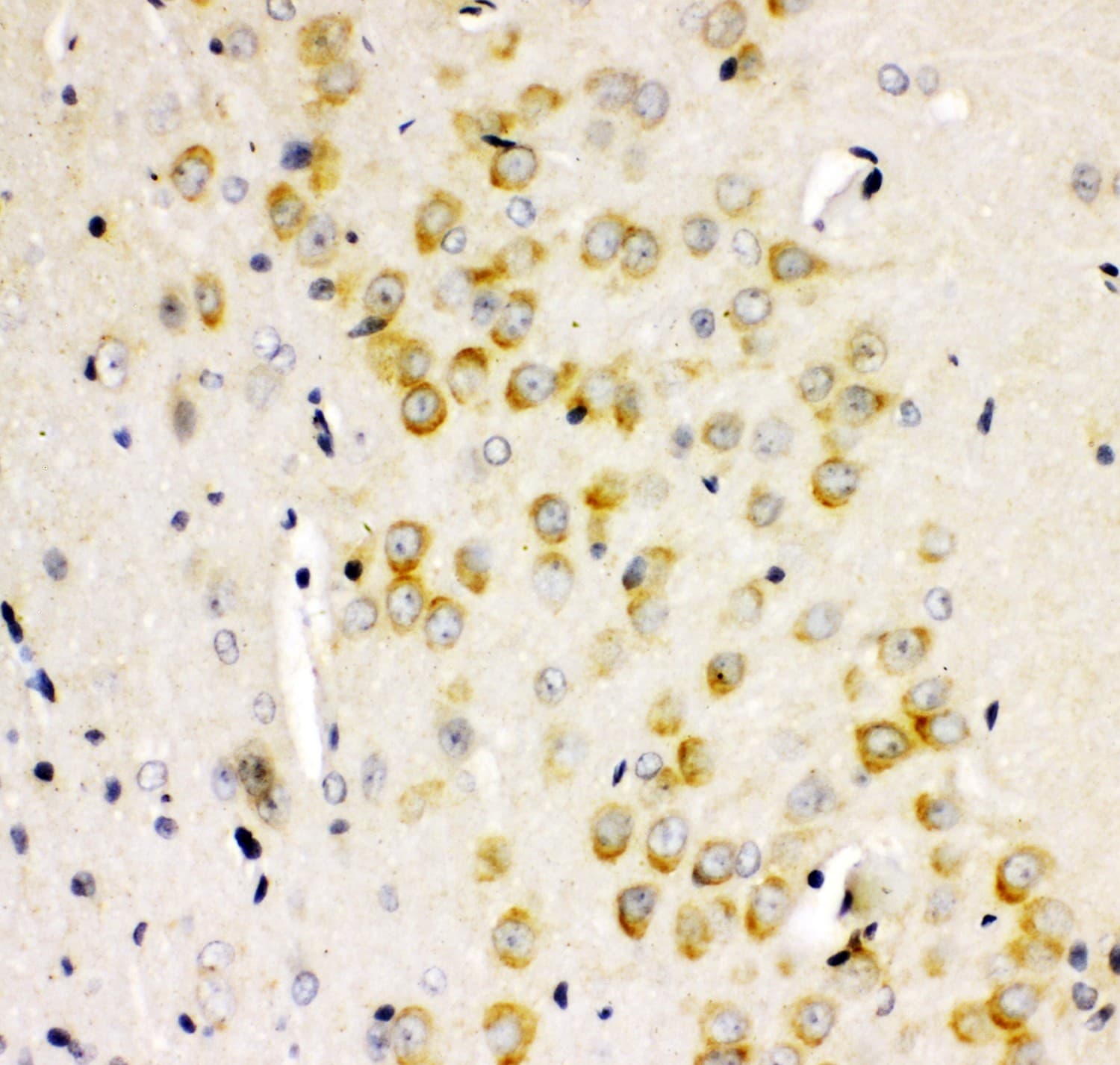 GRIA2 / GLUR2 Antibody (aa25-360)