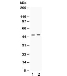 ING1 Antibody