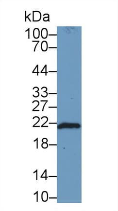 FTH1 / Ferritin Heavy Chain Antibody (aa1-182, APC)