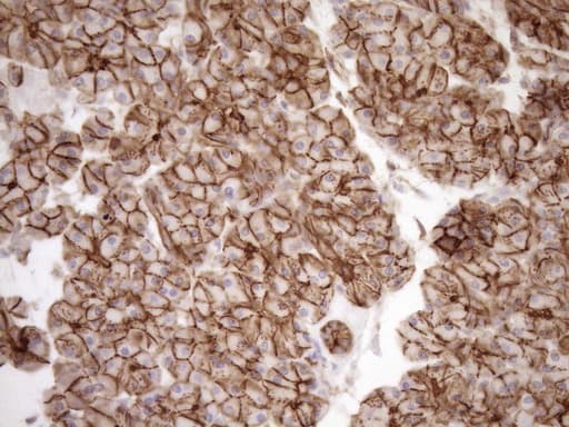 EPLIN Antibody (aa1-275, clone OTI7H5)