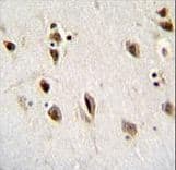 Polyclonal Rabbit anti-Human MSI1 / Musashi 1 Antibody (aa67-93, IHC, WB)