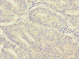 MORN5 Antibody