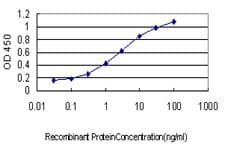 Monoclonal Mouse anti-Human EIF2AK2 / PKR Antibody (clone 1B9, IF, WB)