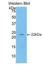 IL-1B / IL-1 Beta Antibody (aa117-268)