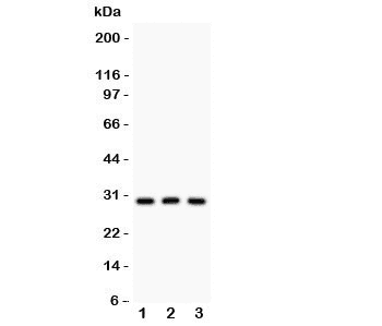 Polyclonal Rabbit anti-Human HOXA9 Antibody (WB)