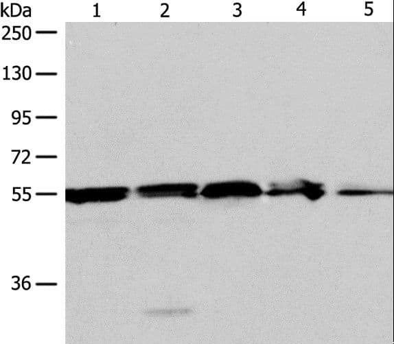 NAMPT / Visfatin Antibody