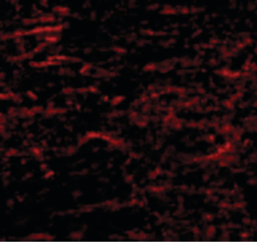 SATB1 Antibody