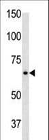 Polyclonal Rabbit anti-Human GFAP Antibody (aa381-410, WB)