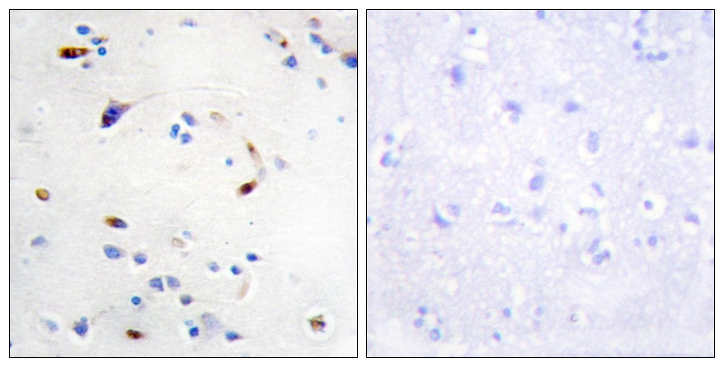 ZEB2 / SIP-1 Antibody
