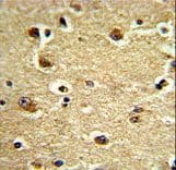 Polyclonal Rabbit anti-Human COT / CROT Antibody (aa49-79, IHC, WB)