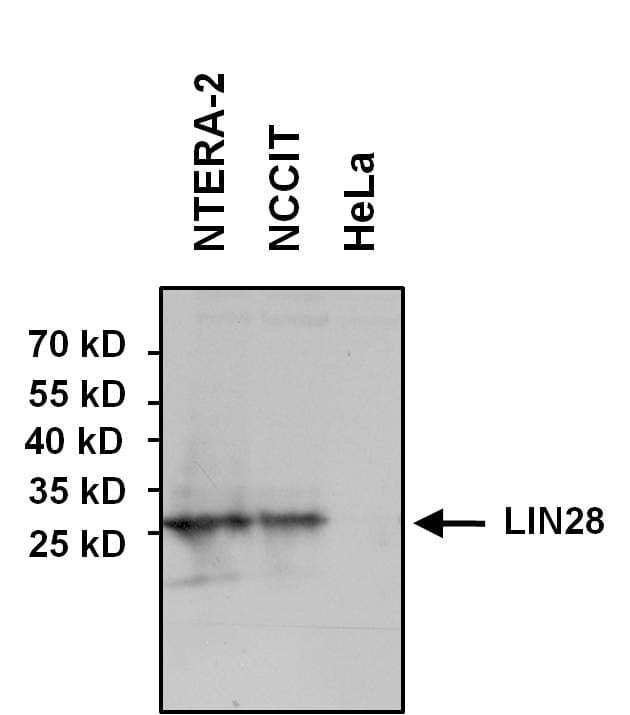IHC-plus™ Polyclonal Rabbit anti-Human LIN28A / LIN28 Antibody (IHC, IF, WB)