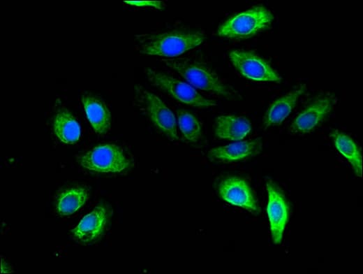 Polyclonal Rabbit anti-Human SCG10 / STMN2 Antibody (IHC, IF)