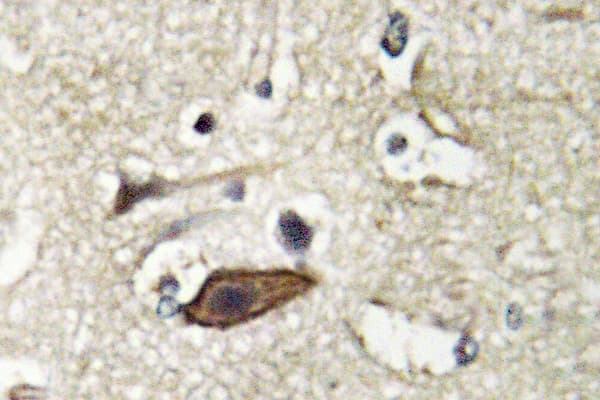 TSG101 Antibody (Glu303)