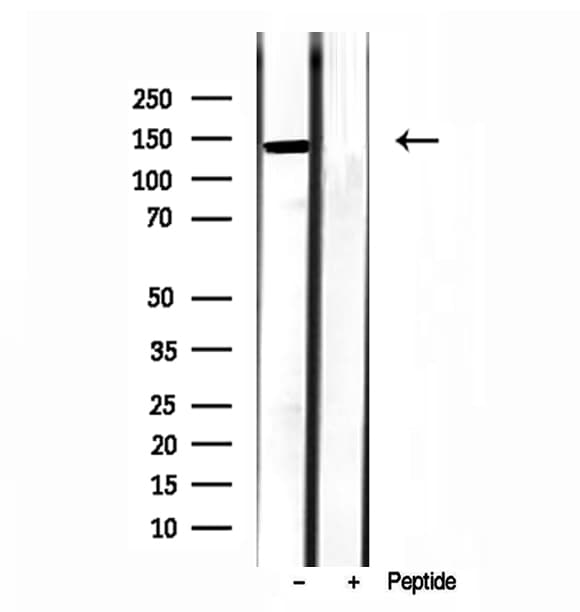 TET2 Antibody
