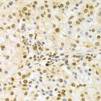 ELAVL1 / HUR Antibody