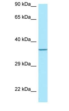 TP53I3 / PIG3 Antibody (aa189-238)