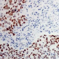 ATF2 Antibody (phospho-Thr73)