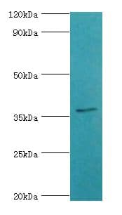 SULT2A1 / Sulfotransferase 2A1 Antibody (aa1-145)