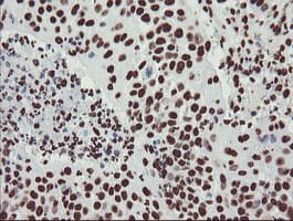 NONO / P54NRB Antibody (aa184-385, clone OTI5F1)