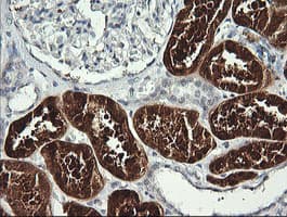 Monoclonal Mouse anti-Human BBOX1 / BBOX Antibody (clone OTI8B12, IHC, WB)