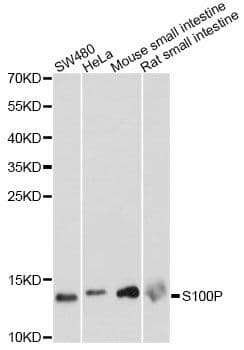 S100P Antibody