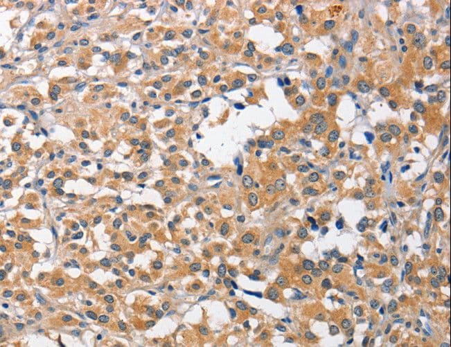 Polyclonal Rabbit anti-Human CCL4 / MIP-1 Beta Antibody (IHC)