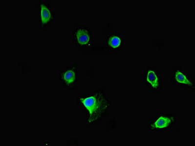 Polyclonal Rabbit anti-Human PRMT5 Antibody (IHC, IF)