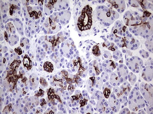 KRT7 / CK7 / Cytokeratin 7 Antibody (aa1-114, clone UMAB161)