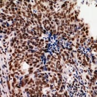 HNRNPUL2 Antibody