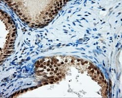 TPMT Antibody (clone OTI5B4)