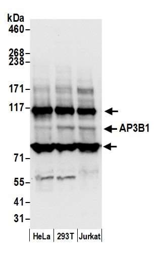 Polyclonal Rabbit anti-Human AP3B1 Antibody (aa725-775, WB)