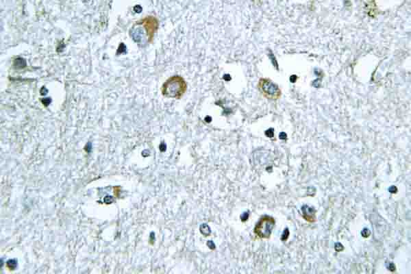 NEURL1 / NEURL Antibody (Val250)