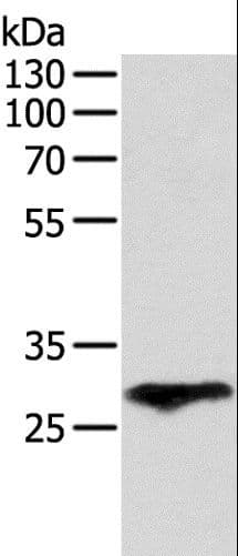 Polyclonal Rabbit anti-Human F3 / CD142 / Tissue factor Antibody (IHC, WB)