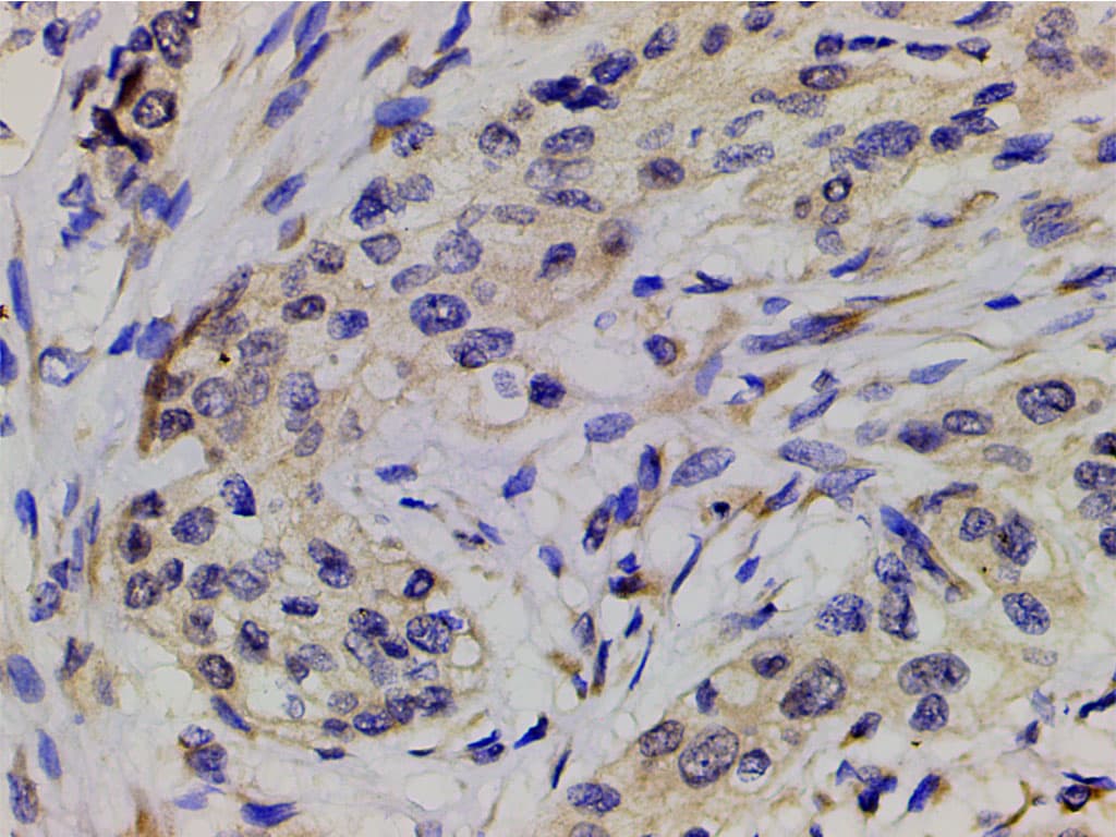 PIK3R1 / p85 Alpha Antibody (phospho-Tyr607)