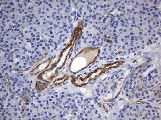 MCAM / CD146 Antibody (clone OTI2B2)