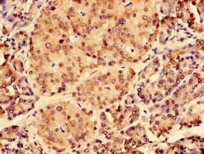 Polyclonal Rabbit anti-Human KIAA1377 Antibody (WB)