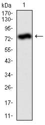 IHC-plus™ ALPL / Alkaline Phosphatase Antibody (aa18-502, clone 2F4)