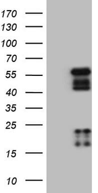 Monoclonal Mouse anti-Human NR2E3 / PNR Antibody (clone OTI3G3, WB)