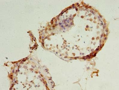 DHRS12 Antibody