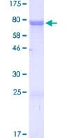 Human ZIC3 Protein (Recombinant GST)