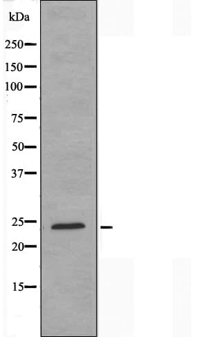 Polyclonal Rabbit anti-Human HMG1 / HMGB1 Antibody (IF, WB)