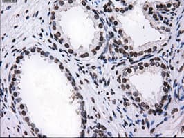 RPA2 / RFA2 / RPA34 Antibody (clone OTI7C12)