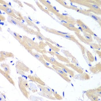 TRIM21 / RO52 Antibody