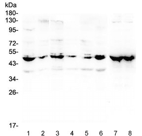 Polyclonal Rabbit anti-Human ENO2 / NSE Antibody (IHC, WB)