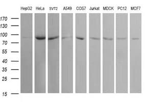 Monoclonal Mouse anti-Human USP16 Antibody (clone OTI1B4, WB)