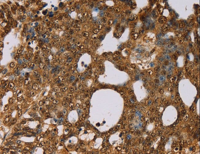 Polyclonal Rabbit anti-Human PSMC2 / RPT1 Antibody (IHC, WB)