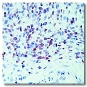 MYOD / MYOD1 Antibody (clone 5.2F)